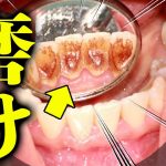 今更ですが、懇切丁寧に歯の磨き方をレクチャーします　Now, I will give a lecture on how to brush your teeth carefully.　歯医者かおりです