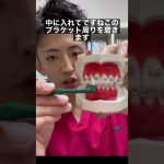ワイヤー矯正中の歯の磨き方 #Shorts