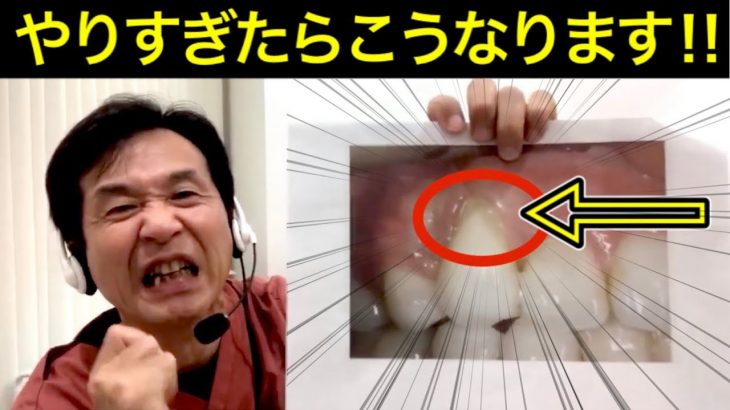 【警告‼磨きすぎ注意‼︎】歯ブラシはサブ！メインの糸ようじ、フロス、歯間ブラシの使い方