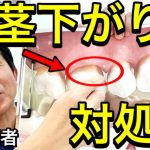 【歯茎下がり】歯の磨きすぎ注意‼︎｜治し方と対処法｜歯医者が解説